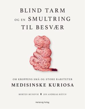 Blind tarm og en smultring til besvær – om kroppens store og små rariteter