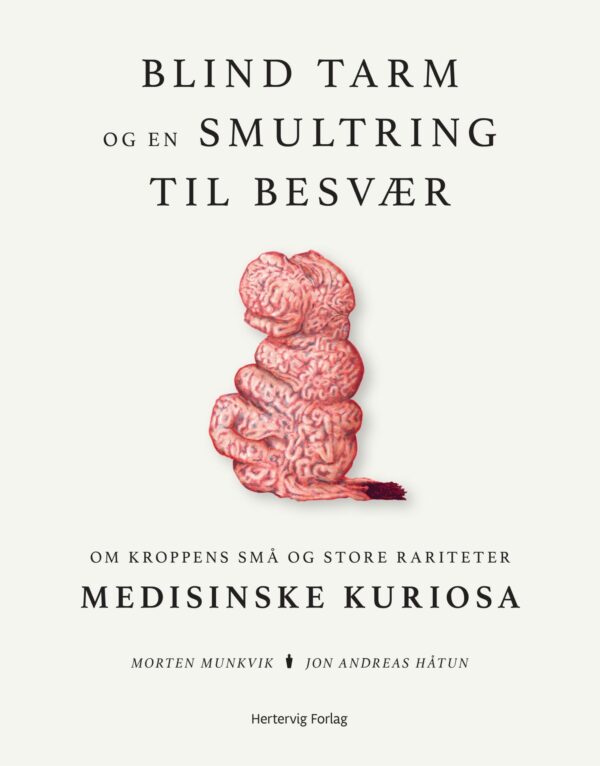 Blind tarm og en smultring til besvær – om kroppens store og små rariteter
